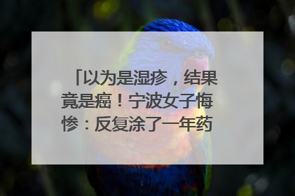 以为是湿疹，结果竟是癌！宁波女子悔惨：反复涂了一年药膏都没好！很多患者首诊都去了皮肤科